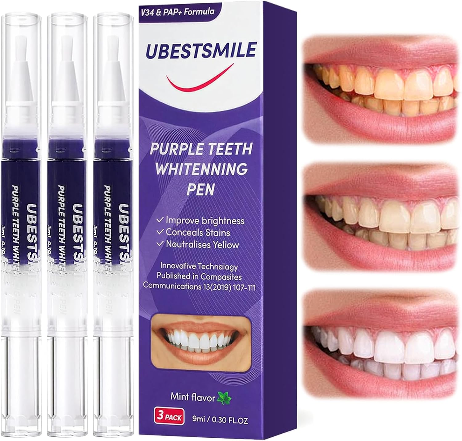 Teeth Whitening Pens - UBESTSMILE V34&PAP+ Formula Lila Zahnaufhellungsstift Tragbar